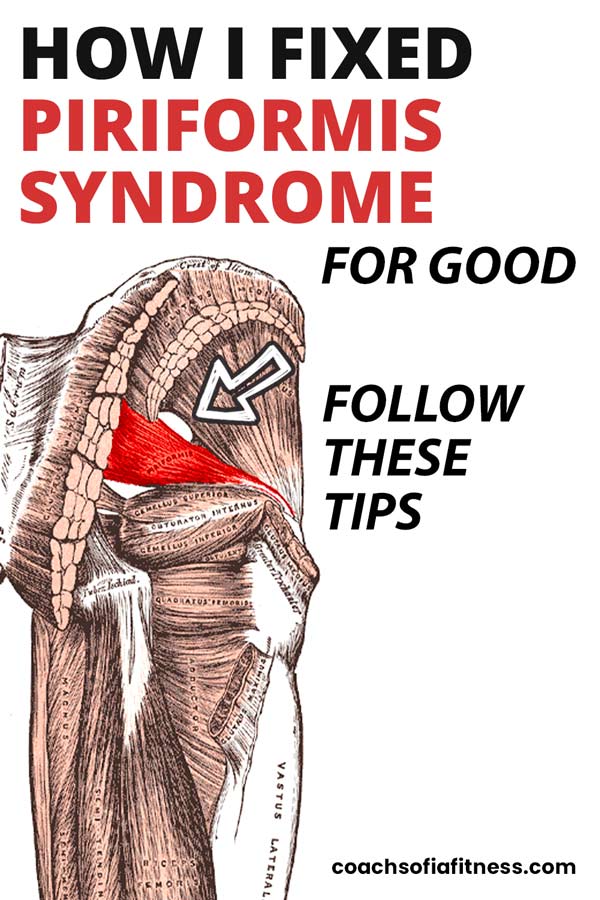 Here's How Long It Takes To Get Rid of Piriformis Syndrome - Coach