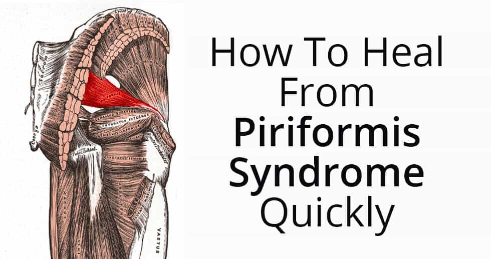 Piriformis syndrome and treatment options - Dr. Zatrok's blog