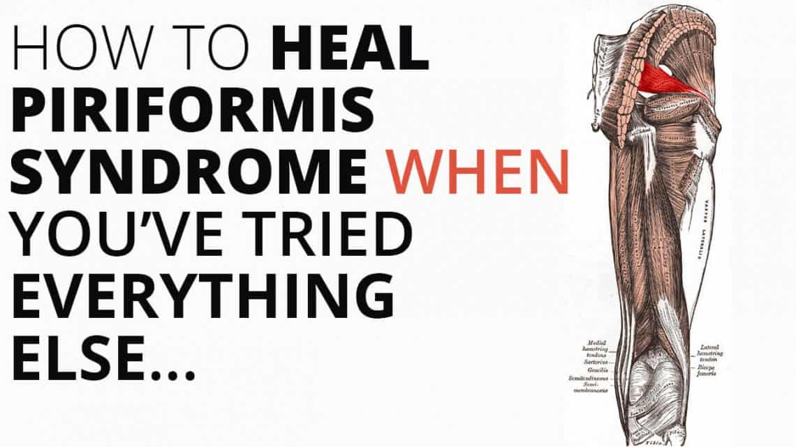 How to Heal Piriformis syndrome When You've Tried EVERYTHING else ...