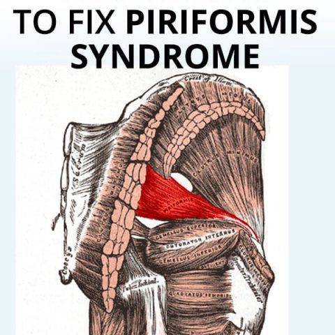 How I Recovered From Piriformis Syndrome (against all odds