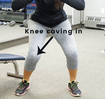 The Snowball Effect of a Weak Gluteus Medius