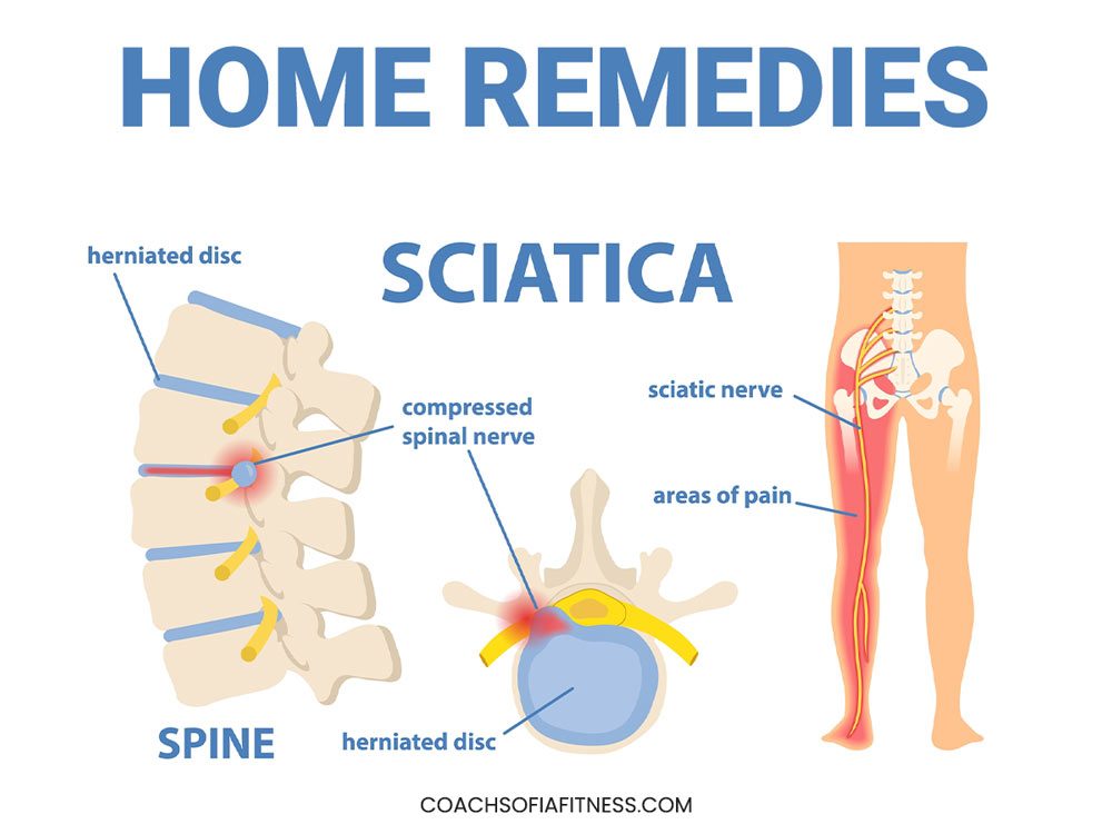 How Does Therapeutic Sciatica Pillow Help Alleviate Sciatica Pain? - IUD  Member Article By