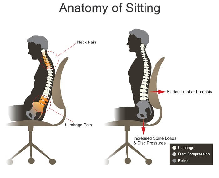 How To Sit With Piriformis Syndrome - Feel Good Life