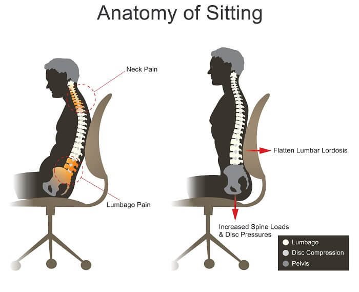 How To Sit Pain Free At Home With Back Pain/Sciatica 