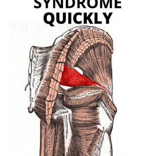 How I Recovered From Piriformis Syndrome (against all odds) - Coach ...