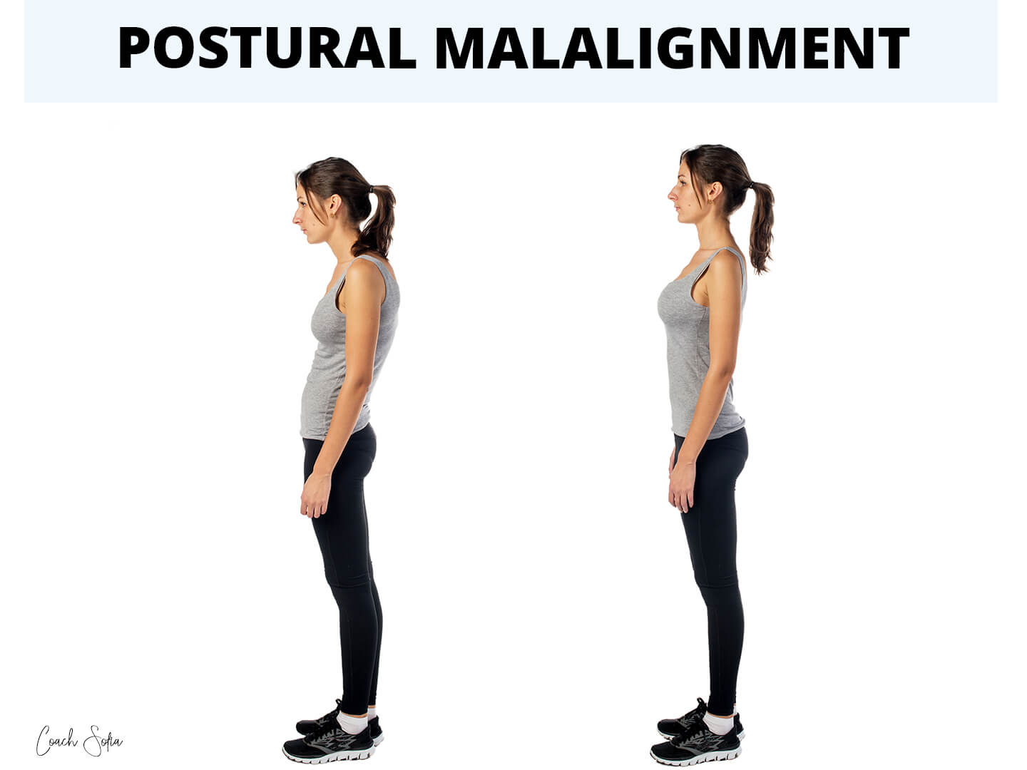 rounded shoudlers forward head posture