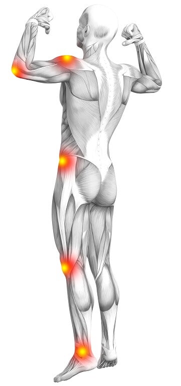 kinetic chain flat feet knee hip back pain diagram