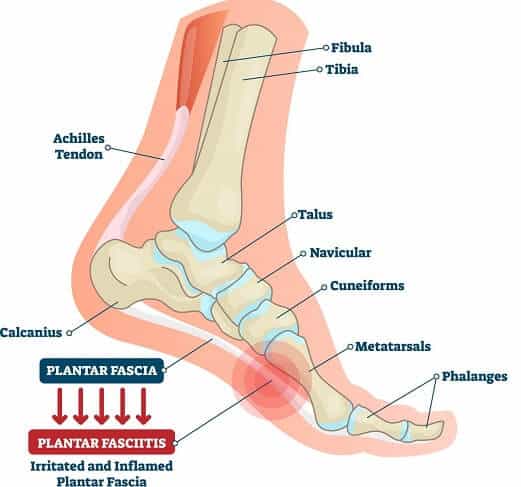 Fix Flat Feet With This One Simple Exercise - Coach Sofia Fitness