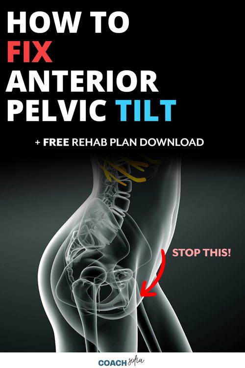 Fix Anterior Pelvic Tilt Exercises 