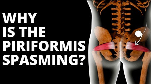 Piriformis syndrome.. has anyone dealt with this? Realizing this