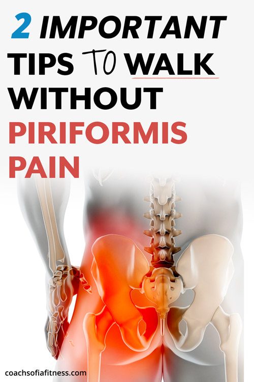 Should You Avoid Walking With Piriformis Syndrome? Infographic
