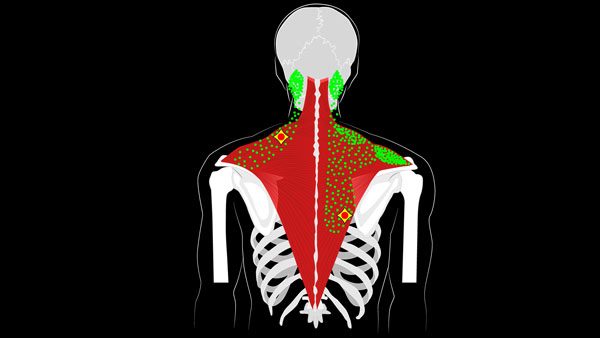 How To Fix Trapezius Pain Fast [Ultimate Guide] 