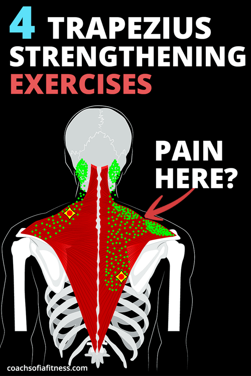 Stretching and Massage Does NOT Get Rid of Upper Trap Pain