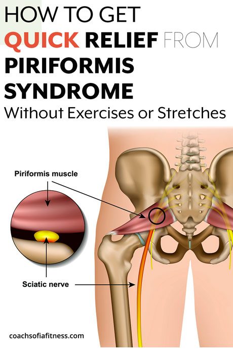 5 Tips for treating Piriformis pain