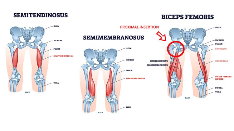 https://coachsofiafitness-1134f.kxcdn.com/wp-content/uploads/2023/03/hamstrings-muscles-anatomy.jpg