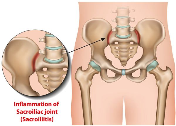 sacroiliac joint exercises